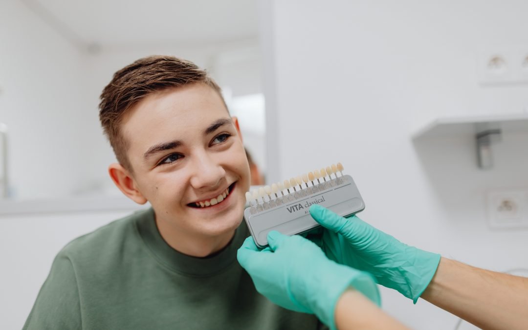 Descubre los 2 Tipos Principales de Blanqueadores Dentales para una Sonrisa Deslumbrante.