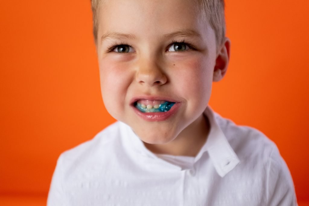 Niño comiendo dulces, probablemente tiene caries inicial