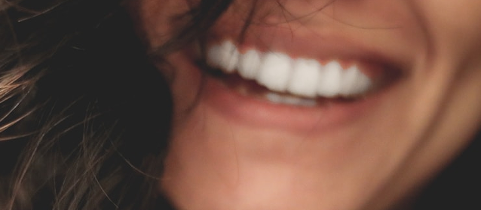 Sonrisa brillante y radiante después del blanqueamiento, ilustrando los resultados de los servicios de Clínica Dental Tenerife.