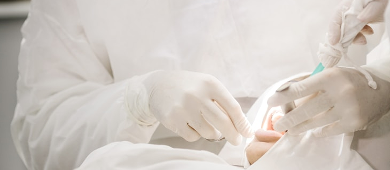 Primer plano de manos de un cirujano con guantes realizando un procedimiento, ilustrando la implantología oral avanzada.