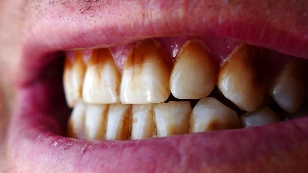 manchas-en-los-dientes