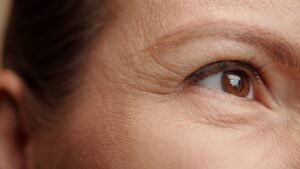 rejuvenecimiento-facial-sin-cirugia